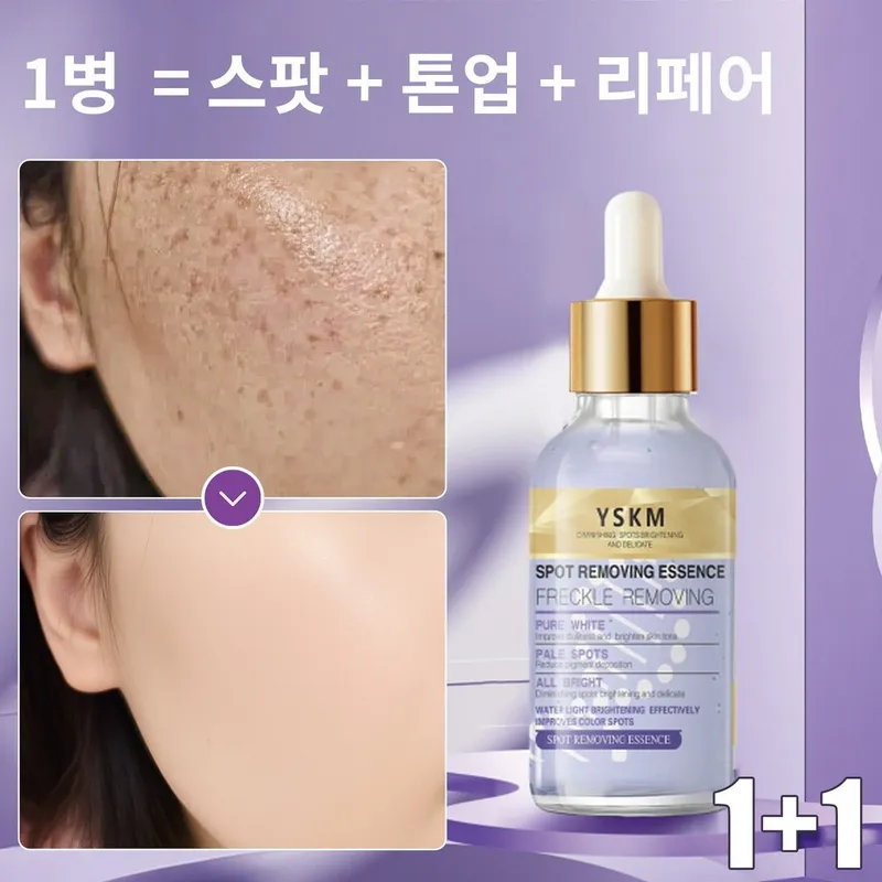 [기미관리] 멜라논 크림 기미 잡티 제거 크림1위 미백 세럼/ 기미 크림 / 여드름 흉터/잡티 제거 / 주근깨 완화 / 니아신아마이드+알부틴+트랜엑산산, 2개, 30g